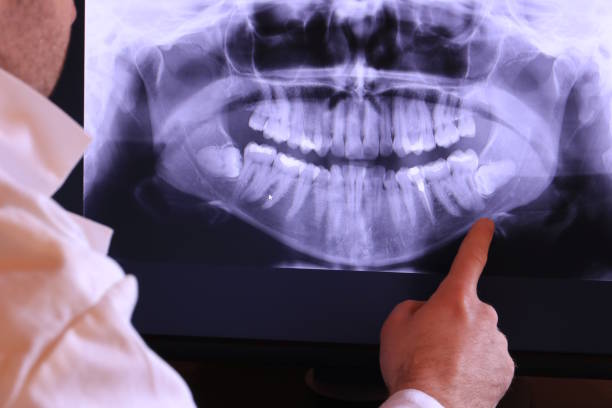 Best Weekend Emergency Dentist in Kensington, MD