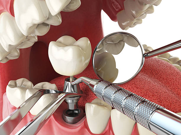 Best Same-Day Emergency Dental Services in Kensington, MD