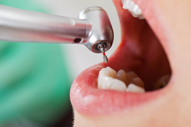 Best Emergency TMJ Treatment in Kensington, MD